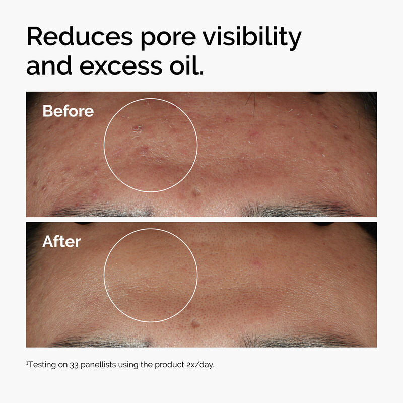 Ordinary Serum Niacinamide 10% + Zinc 1%